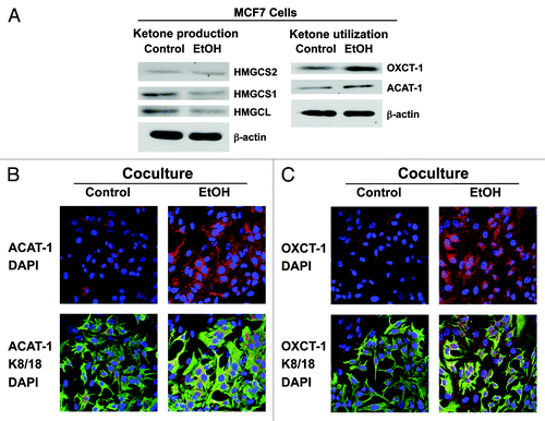 Figure 6. Ethanol promotes ketone body utilization in MCF7 cells. (A) Western blot analysis. Control and EtOH-treated MCF7 cells were analyzed by immunoblotting with a panel of antibodies against key enzymes of ketone body metabolism (production and utilization). β-actin was used as equal loading control. Note that treatment with EtOH induces the expression of key enzymes involved in ketone utilization (ACAT-1 and OXCT1). The expression of key enzymes involved in ketone body production (HMGCS1, HMGCS2 and HMGCL) is unchanged or slightly decreased. (B and C) Immunofluorescence. Fibroblast-MCF7 cell co-cultures were treated with 100 mM EtOH for 72 h. Cells were then fixed and immunostained with antibodies against K8/18 (green) and ACAT-1 [red, (B) or OXCT-1 red, (C)]. Nuclei were counterstained with DAPI (blue). The upper panels show ACAT-1 or OXCT-1 staining (red). The bottom panels show also the K8/18 staining (green) to identify the MCF7 cell population. Note that ethanol increases the expression of enzymes for ketone bodies utilization [ACAT-1, (B); and OXCT-1, (C)] in cancer cells in co-culture with fibroblasts. Original magnification, 40x. These data indicate that ethanol increases ketone body utilization in MCF7 cancer cells.
