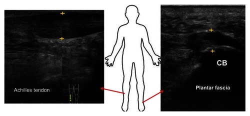 Figure 3 Sonographic appearance of common problems in the lower limb.