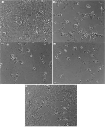 Figure 11. (a) Microphotograph of MCF-7 cancer cell (b), (c), (d) and (e) FS, FS-PF micelles, FS-PF-FA micelles and blank PF-FA micelles treated MCF-7 cancer cell.