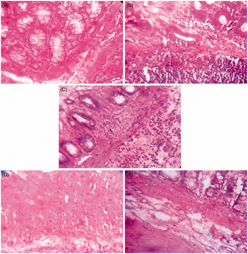 Figure 5. Effect of APME and APAE on histology of colon. Histological sections of colon from saline treated NC rats (A) showing normal architecture. Colon section from acetic acid treated EC rats (B) that received vehicle shows severe thickened mucosa, increased infiltration of inflammatory cells, edema, sloughing of mucosa, tissue necrosis and mild hemorrhage as compared to normal rats (NC). Section of colon from acetic acid treated rat which concurrently received PRDS (4 mg/kg) (C), APME (500 mg/kg) (D) and APAE (500 mg/kg) (E) orally for seven days shows a marked decrease in infiltration of inflammatory cells, edema, sloughing of mucosa, tissue necrosis and hemorrhage and indicates the prevention of the damage compared to vehicle treated EC group. (Type of staining: Hematoxylin and Eosin. Magnification: ×400).