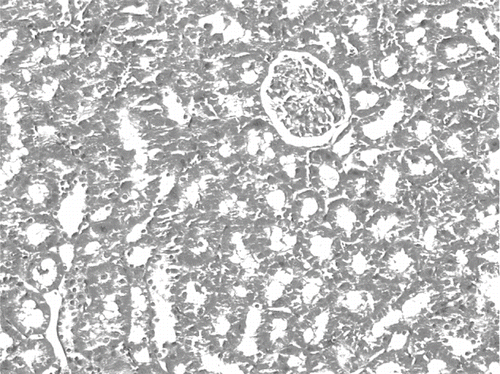 Figure 7. Kidney section of a control rat. There are no granular deposits in iron-stained section (iron stain, × 100).