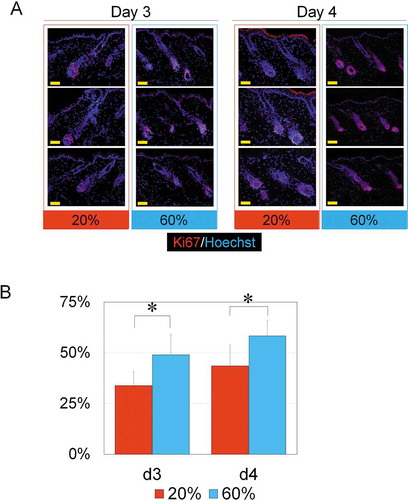 Figure 4. NBO effects on hair follicles in early anagen phase.