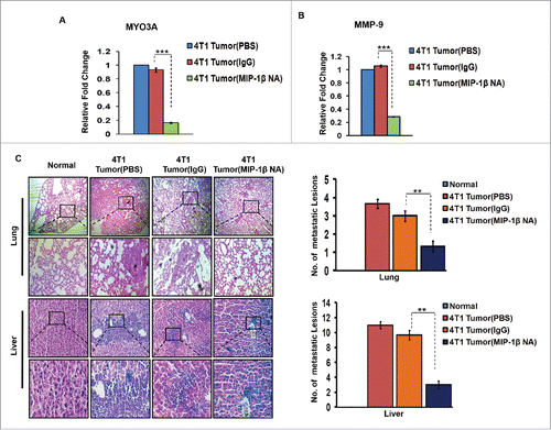 Figure 9. Diminished expression of MMP-9 and MYO3A upon neutralizing antibody-mediated blockade of MIP-1β function was followed by reduced cellular burden in lungs and diminished presence of metastatic foci in liver of syngenic 4T1/BALB/c mouse model of breast cancer. (A and B) Anti-mouse MIP-1β goat IgG polyclonal antibody-treated 4T1 tumors expressed much lower invasive potential as revealed by significantly downregulated mRNA expression levels of MYO3A. The mRNA expression levels of MMP-9 gene were significantly downregulated. Bars represent Quantitative RT-PCR relative fold change expression ±SE (*p <0.05). (C): On day 26th post grafting, compared to controls (PBS or isotype control antibody (IgG)), the intratumoral administration of MIP-1β-neutralizing antibody (MIP-1β NA) resulted in reduced cellular burden in lungs and perivascular regions of liver from 4T1/BALB/c mouse models. Lung and liver sections obtained from healthy uninoculated mice served as mock control. Bars represent no. of metastatic lesions ±SE (*p < 0.05.). All the experiments were done in triplicates. All the experiments were done in triplicates. Abbreviations—4T1 tumor (PBS): 4T1-induced tumor treated with PBS; 4T1 tumor (IgG): 4T1-induced tumor treated with isotype control antibody; 4T1 Tumor (MIP-1β NA): 4T1-induced tumor treated with MIP-1β-neutralizing antibody.