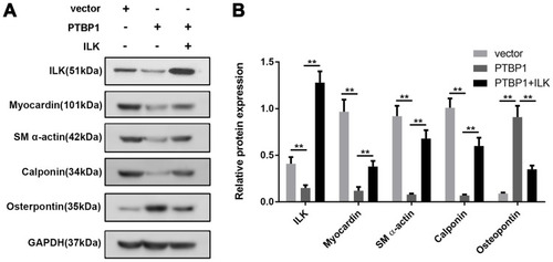 Figure 3 PTBP1 inhibits ILK and downstream signaling pathway protein expression. (A) The expressions of ILK, Myocardin, SM a-actin, Calponin, and osteopontin were detected by Western blot. (B) Statistical results of expression changes of ILK, Myocardin, SM a-actin, Calponin, and osteopontin. n=6, **p<0.01.