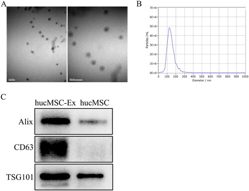 Figure 1. Characterization of hucMSC-Ex. (A) Morphology of hucMSC-Ex under TEM. Scale bar, 200 nm. (B) The mean diameter of hucMSC-Ex was analyzed by NTA. (C) The exosome protein markers Alix, CD63, and TSG101 were detected by Western blot (n = 3).