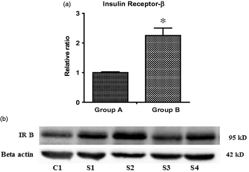 Figure 3. (a) Relative ratio of IR-B/Beta actin protein expression in prostate tissues of BPH patients. Data were expressed in Mean ± SEM, *indicates statistically significant, p values – .05 for IR-B. (b) First line (C1) represent Group A (<30 ml prostate size), next four lines (S1, S2, S3, S4) represents Group B (>30 ml prostate size).