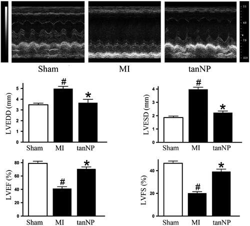 Figure 2. Effects of tanshinone IIA-NP on cardiac function after MI. Representative photographs of M-mode echocardiography and quantitative analysis of LV dimension and systolic function in mice exposed to shamoperation or coronary artery ligation with or without tanshinone IIA-NP treatment. (n = 12). LVEDD: LV end-diastolic diameter; LVESD: LV end-systolic diameter; FS: fractional shortening. #p < .05 versus Sham; *p < .05 versus MI.