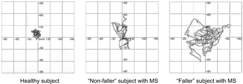 Figure 3 Statokinesigrams collected by one healthy volunteer, one patient who did not report any fall and one patient who reported three accidental falls within the last 3 months.
