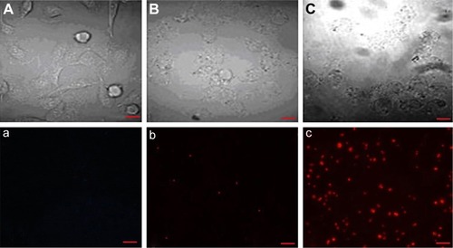 Figure 4 Confocal microscopy reveals the targeting of sodium morrhuate immunoliposomes to HECs. (A and a) Control group; (B and b) liposomal sodium morrhuate group; (C and c) sodium morrhuate immunoliposomes group. Scale bars =50 μm.Abbreviation: HEC, hemangioma endothelial cell.