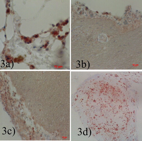 Figure 3. (a) Airsac, high intranuclear and intracytoplasmic staining in cells. (b) Meningeal epithelial lining cells intranuclear and intracytoplasmic staining. (c) Cerebral and meningeal epithelial lining cells intranuclear and intracytoplasmic staining, moderate. (d) Pancreas, severe intranuclear and intracytoplasmic staining in acinar cells X100, IHC.