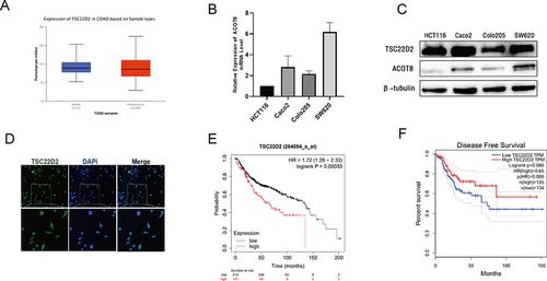 Figure 1 TSC22D2 expression in CRC cell lines predicted poor survival. (A) Expression of TSC22D2 in tumor and non-tumor tissues in TCGA database. (B and C) mRNA and protein expression of TSC22D2 in CRC cells. (D) Immunofluorescent images show the TSC22D2 protein primarily localized to the cell cytoplasm. (E and F) TSC22D2 expression and CRC patients’ clinical prognosis.
