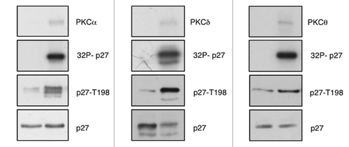 Figure 2. PKC phosphorylates p27 at T198. In vitro kinase assays. Recombinant p27 was incubated with recombinant PKCs in presence of 32P-labeled adenosine triphosphate (ATP), fractionated by SDS-PAGE, and transferred to nylon membrane. p27 phosphorylation was determined either by autoradiography or by immunoblot using an antibody specific for phosphorylated T198 (anti-pT198).