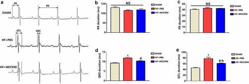 Figure 2. Analysis of surface electrocardiograph in the three groups of mice. (a) A representative trace of surface electrocardiograph for each of the three groups. Surface electrocardiograph parameters of RR duration (b), PR duration (c), QRS duration (d), and QTc duration (e) in the three groups. Data are expressed as the mean ± SEM. *P < 0.05 vs. sham, # P < 0.05 vs. HF-PBS. NS, not significant, &P < 0.05 vs. sham.