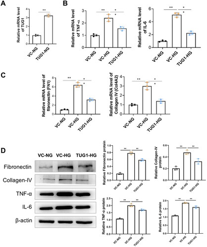 Figure 3. Over-expression of TUG1 reduces proinflammation and profibrotic caused by high glucose toxicity in HK2 cells. (A) Relative expression of TUG1 increased after TUG1 transfection; (B) mRNA levels of TNF-α and IL-6 in HG-treated HK2 cells were significantly reduced by overexpression of TUG1; (C) mRNA levels of fibronectin (FN1) and collagen IV (COL4A2) in HG-treated HK2 cells were significantly reduced by overexpression of TUG1; (D) protein levels of fibronectin, collgen IV, TNF-α and IL-6 by Western blot. **p < 0.01.