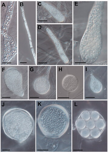 Figure 3. Morphological characteristics of Saprolegniaceae isolates obtained from the present study. Microscopic structures observed under a microscope: filiform sporangium (A) and oospore contenting finely granular (K) of Geolegnia helicoides W732, filamentous sporangium (B) of Leptolegnia caudata W1297, clavate sporangium of Saprolegnia aenigmatica W1247 (C), and S. ferax W956 (E) cylindrical sporangium (D), oogonia (G, H) and oogonia with centric oospores (L) of S. diclina W724, pyriform gemmae (F) and oogonia (J) of S. ferax W956, pyriform oogonia of S. aenigmatica W1247 (I) (scale bars: A–D, F, G, I, J, L = 20 μm, E, H, K = 10 μm).