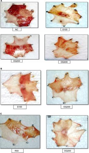 Figure 2 (A) Ethanol-induced ulcer: single-dose study. (B) Ethanol-induced model: 10 days of pretreatment or repeated-dose study. (C) Ethanol-induced model: 20 days of pretreatment or repeated-dose study.Notes: As shown in (A), the extract demonstrated better anti-ulcer effect at the higher dose (OQ400). (B and C) demonstrate that the extract 200 mg\kg dose possess better anti-ulcer effect when taken repeatedly.Abbreviations: OQ, Osyris quadripartita; R50, ranitidine 50 mg/kg; NC, negative control; S100, sucralfate 100 mg/kg; OQ200, 200 mg/kg of extract; OQ400, 400 mg/kg of extract; R50, ranitidine 50 mg/kg.