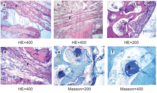Figure 3 HE staining and Masson’s staining of material implanted in muscle. a, b–c, d, e–f were the histological reaction at 2, 4, 12 and 26 weeks respectively.Abbreviations: B, bone lacuna; F, fibrous capsule.