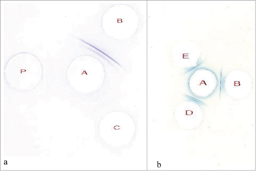 Figure 6. Double immunodiffusion test images of antigen reactivity: (A): before loading (B), after release in simulated gastric condition (C) and PBS (P), (B): before loading (B), after release in simulated intestinal ( D), release in intestinal simulated condition after treatment in gastric simulated condition (E), [Anti-HBs Ag (A), HBs Ag (B)].