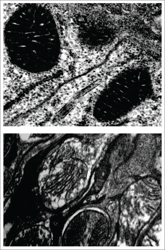 Figure 1. The brains of aged flies lacking the iPLA2-VIA gene show degenerate mitochondria with abnormal cristae at the ultrastructural level (lower panel), compared with age-matched control (top panel).