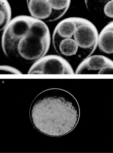 Figure 2. (a) Gel beads formed in the 100 mM CaCl2 in the first step of the two-step encapsulation method. Each large bead usually contains 3 small beads. (b) Microcapsules made by two-step encapsulation, after the inner small beads solubilize, the capsular membrane is uniform, no cells are seen entrapped in the membrane.