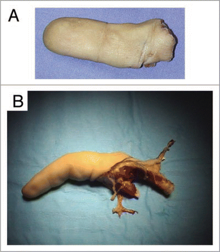 Figure 1 Recovered xenografts. (A) An index severed in zone II from a hand laborer, which did not fulfill conditions allowing microsurgical revascularization. (B) A stiff finger that hindered functioning of the hand was removed during a scheduled operation.