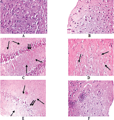 Figure 5.  Histopathological examination of Hematoxylin and eosin stained Brain sections of normal and experimental rats (each group containing 6 rats) with magnification × 400. A. Normal, B. NaAsO2 treated (6 mg./kg. b wt.) C. NaAsO2 (9 mg./kg. b wt.) treated, D. NaAsO2(12 mg./kg. b wt.), E. NaAsO2+Free QC treated, F. NaAsO2+Liposomal QC treated. ↓, nerve cell loss, ↓↓, clustering of nerve cells.