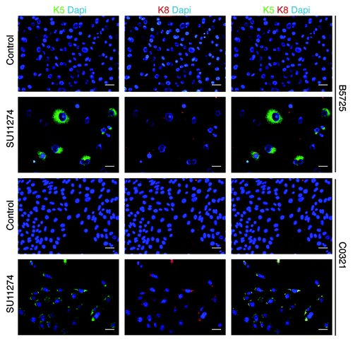 Figure 6. Increased cytokeratin expression in TNBC cells treated with Met inhibitor. Shown are representative images of the immunofluorescence staining for cytokeratin 5 (K5) and cytokeratin 8 (K8) in B5725 and C0321 cells after 48h treatment of SU11274 (6 μM) or DMSO as control. Dapi staining is for the nucleus. Merged images for anti-K5 (green) and anti-K8 (red) staining are shown at the right. Scale bar: 20 μm.