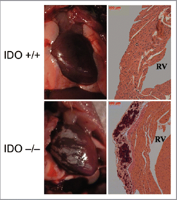 Figure 1 Calcification of the cardiac endometrium in IDO deficient BALB/c mice. Representative illustrations of gross pathology (left panels) and representative histology (right panels) are shown of calcification of the cardiac endometrium proximal to the right ventricle which were observed in female animals with a ∼30% penetrance. RV, right ventricle.
