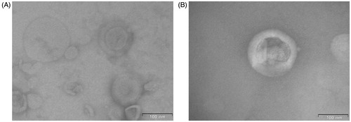 Figure 1. TEM images of (A) non-targeted and (B) targeted Epirubicin-HCl liposomes.
