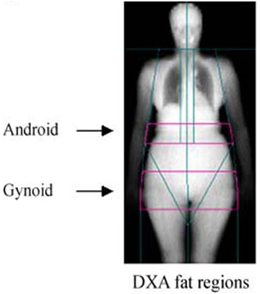 Figure 1 Regional body composition measurement and regions of interest (ROI) in the android and gynoid by dual-energy X-ray absorptiometry (DXA).