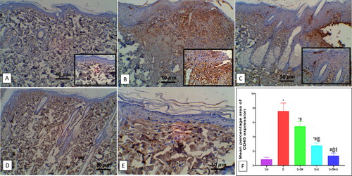 Figure 7. Representative photomicrograph of CD45 immunoexpression in skin section of different groups. A: the control group shows no expression of CD45-positive cells in lower and higher power images (inset images). B: the diabetic group shows high expression in the dermal capillary, Intravascular blood cells, and dermal cellular infiltrates. C) The diabetic + ZW group shows few epidermal and dermal expression, inset, few positive immunostained epidermal and subepidermal endothelial cells. D and E: the diabetic + dapagliflozin and diabetic + ZW + dapagliflozin groups show faint expression in dermal tissue. F: Histogram showing the percentage of skin that was immunostained with CD45. * vs. Control group; # vs. Diabetic group; @ vs. Diabetic + ZW group, and $ vs. Diabetic + dapagliflozin group. Image magnification = 400X, bar = 50 µm.