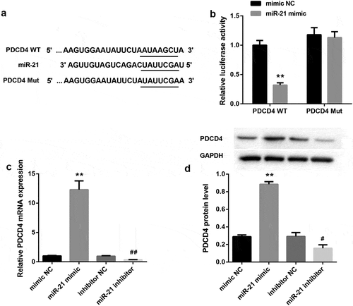 Figure 4. miR-21 directly targeted to PDCD4 3ʹ-UTR and negatively regulated PDCD4 expression(a). The putative miR-21 binding sites in PDCD4 (PDCD4-WT) or and the designed mutant sequence (PDCD4-Mut) were indicated. (b) Luciferase report assay delineated a reduction in luciferase activity of PDCD4-WT reporter after introduction of miR-21. The mRNA (c) and protein (d) levels of PDCD4 in HK-2 cells which were transfected with miR-21 mimic, miR-21 inhibitor, and corresponding negative controls.