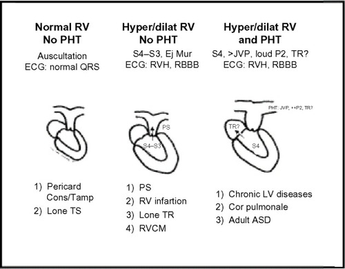 Figure 2 Diagnostic construction of right heart diseases.