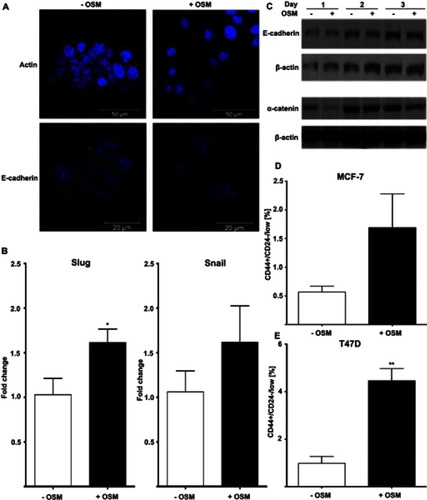 Figure 1 OSM induces EMT and a BCSC phenotype in human breast cancer cells (A) MCF-7 luc human breast cancer cells were treated with OSM (25 ng/mL) for 72 hrs. OSM induces an increased mesenchymal phenotype and a decrease in E-cadherin expression, as measured by immunofluorescence using antibodies for E-cadherin and actin (63× magnification). (B) MCF-7 cells were treated with OSM (25 ng/mL) for 1 hr, and qPCR was performed with primers for the EMT transcription factors Slug and Snail (*P<0.05, unpaired t-test). (C) MCF-7 cells were treated with OSM (25 ng/mL) for 24, 48 and 72 hrs, and cell lysates were assessed by Western blot analysis for E-cadherin and α-catenin (D and E). ER+ MCF-7 and T47D cells were treated with OSM (25 ng/mL) for 72 hrs before flow cytometry was performed. In T47D cells, OSM induces the CD44+/CD24− BCSC population 3-fold, while a small non-significant increase was seen in MCF-7 cells. **P<0.01, *P<0.05, unpaired t-test.