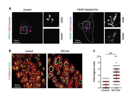 Figure 2. EPC-EVs are taken up by embryonic thyroid progenitors and stimulate folliculogenesis.(A) Immunofluorescence for CD63 (red) of cultured embryonic thyroid progenitors without (left panel) or after incubation with PKH67-labeled EVs (green; right panel). Cell contours are delineated by dotted lines. Note clustering around cell. High magnifications of the boxed areas at left are shown at right in single channels for CD63 and PKH signals. (B) Immunofluorescence on sections of thyroid explants cultured without (control) or with EPC-EVs for E-cadherin (red) to define epithelial cells and ezrin (green) to identify their apical pole, thus lumen contour. (C) Folliculogenic index in control- and EPC-EVs-treated explants determined by quantification of ezrin+ open follicles (***p < 0.001; n = 5).