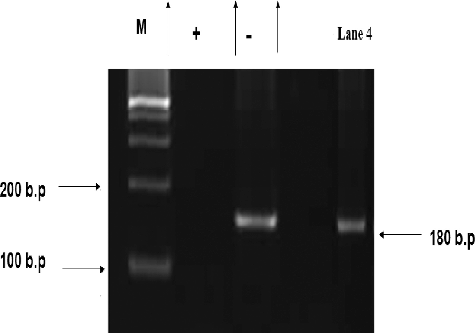 Figure 8. Nested PCR detection of anti-HCV activity of S. parvus' extract.