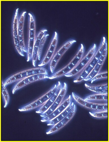 Figure 1. Photomicrograph of Fusarium lateritium macroconidia (average size ranged from 26 – 50 µm by 3 - 4 µm) as grown on modified vegetable juice agar (Miller, Citation1955).