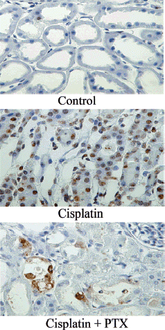 Figure 4. Effect of pentoxifylline (PTX) pretreatment on apoptosis in the renal cortex in cisplatin-injected rabbits. Animals were sacrificed 48 h after cisplatin injection. Normal rabbits did not receive any drug. Apoptotic cells were evaluated by terminal deoxynucleotidyl transferase (TdT) mediated fluorescein-dUTP nick-end labeling (TUNEL) staining in the kidneys of normal (A), cisplatin-treated (B), and cisplatin + PTX-treated animals (C). (Go to www.dekker.com to view this figure in color.)