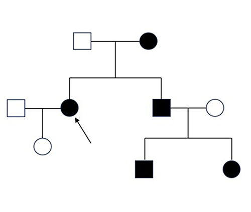 Figure 2 The family genetic map (the arrow points to the patient).