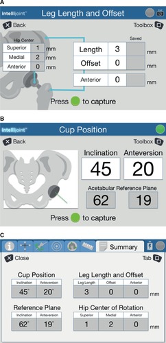 Figure 3 Representative images of the workstation screen indicating data provided to surgeons in real time.