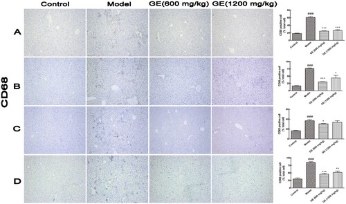 Figure 3. Activation of Kupffer cells in different models. Representative images (×100) of immunohistochemical staining for CD68 in liver tissue. (A) acute liver injury model, (B) liver fibrosis model, (C) liver cirrhosis model, (D) the first stage in hepatocellular carcinoma. All values are expressed as mean ± S.E.M. (n = 7). ###p < .001 vs. control group; *p < .05, vs. model group; **p < .01, vs. model group; ***p < .001, vs. model group.