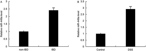 Figure 1. Expression of miR-449a in IBD. The expression level of miR-449a in IBD was detected using qRT-PCR. A: Relative miR-449a expression in colonic mucosa of 30 children with IBD or 30 children without IBD (** p < 0.01 vs. non-IBD); B: Relative miR-449a in the normal intestinal epithelial cells Caco-2 treated with or without DSS (**p < 0.01 vs. Control group). Data are displayed as mean values ± SD.