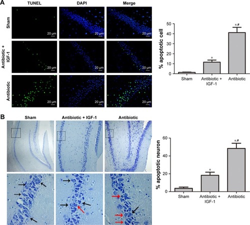 Figure 9 Inhibition of cell apoptosis in the hippocampus is associated with improvement of memory and learning during sepsis.