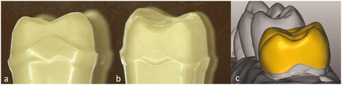 Figure 1. The molar preparation with curvatures on the approximal sides to resemble clinical preparations. (a) mesial view, (b) distal view and (c) the designed crown from the distal view.