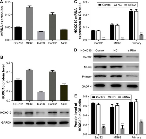 Figure 2 The expression of HOXC10 was decreased after RNA interference.