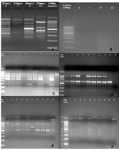 Figure 2 RAPD-PCR patterns produced from the genomic DNA of Schistosoma haematobium isolated from 20 infected patients generated by four oligoprimers. (A) Positive control. (B) Negative control. (C) DNA Pattern generated with Primer A02. (D) DNA Pattern generated with Primer A07. (E) DNA Pattern generated with Primer A09. (F) DNA pattern with Primer A10. Bands were visualized by 1.2% agarose gel electrophoresis stained with ethidium bromide.