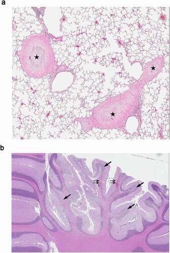 Figure 2. Histological evaluation of cynomolgus monkey tissues. 13 weeks IV administration (once weekly) with 60 mg/kg ABT-736 (a) lung; thrombosis and medial hyperplasia of large lung arteries (star); (b) brain; hemorrhage (double arrows) and degeneration of Purkinje cells and granule cell layer (arrows). Hematoxylin and eosin stain