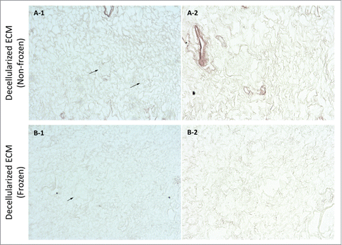 Figure 7. Orcein stain imaging for frozen/thawed and non-frozen decellularized kidney samples at magnifications of 10X (A-1 & B-1) and 20X (A-2 & B-2). Generally, the elastin fibers were damaged as a result of freezing/thawing (affinity for Orcein stain color was lower for frozen/thawed samples which resulted in lighter color in images). Also it appeared that because of fibril damage the structure was more porous and had less integrity as white spaces were more frequent in frozen/thawed samples (arrows show renal corpuscles).