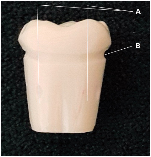 Figure 2. Master tooth. (A) CEJ line. (B) Surface demarcations.