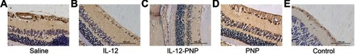 Figure 6 Analysis of MMP-9 expression in rat retina 7 d after intravitreal IL-12 or IL-12-PNP injections. Immunohistochemical assays were performed on tissue sections stained with rabbit anti-rat MMP-9 antibody and hematoxylin-eosin (H&E). Bar =100 μm.